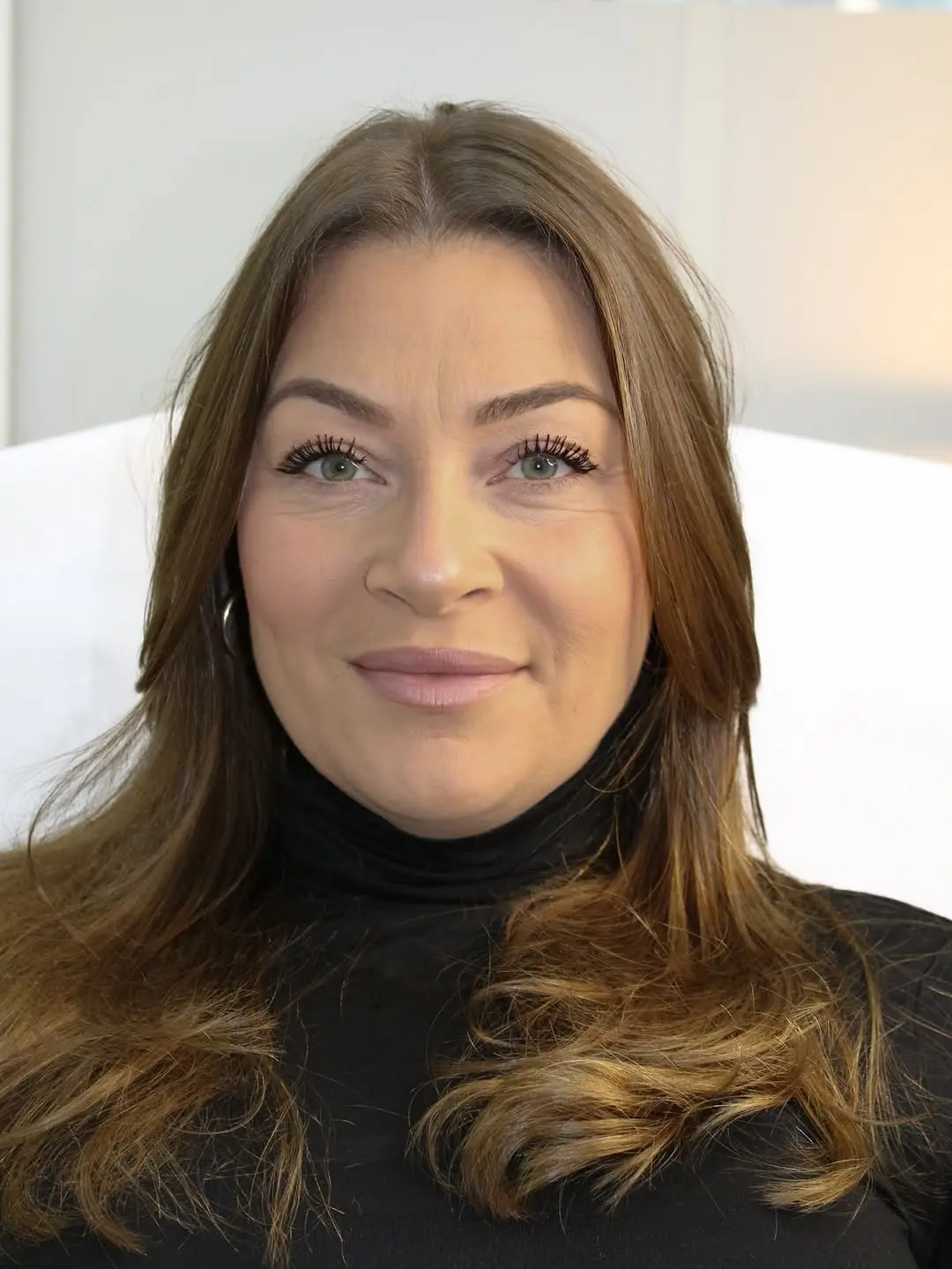 Voor Profhilo Glow behandeling